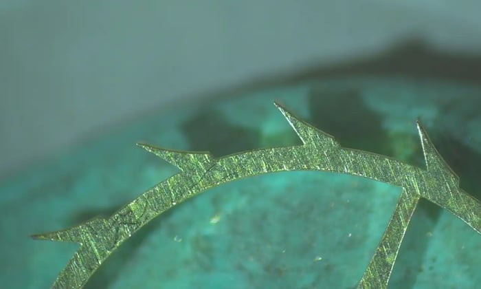 Figure 6: Teeth post-treatment 