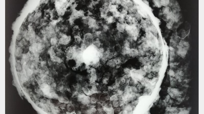 Fig 2 : X-ray - plan view of the shield boss.  